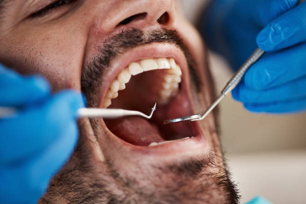 Best Root Canal Emergency Dentist  in Doffing, TX